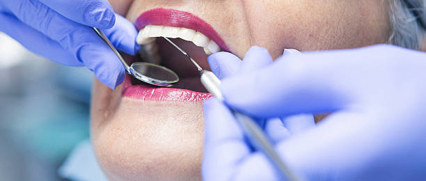 Best Emergency Dental Care for Broken or Chipped Teeth in Arvada, CO